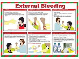 External bleeding treatment guide.